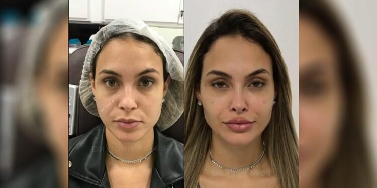 Harmonização Facial: Esclarecendo as Principais Dúvidas para uma Beleza em Equilíbrio