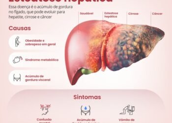 Gordura no Fígado Atinge 30% da População