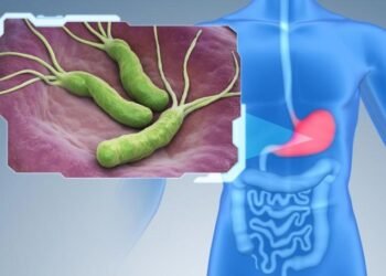 H. pylori Não É Único Culpado no Câncer de Estômago