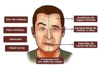 AVC: Sintomas sutis podem salvar sua vida. Saiba reconhecer