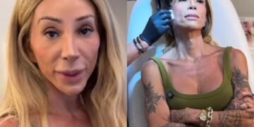 Rosto de Maya Massafera Inflama Após Cirurgia: 'Dor e Medo', Declara Influenciadora